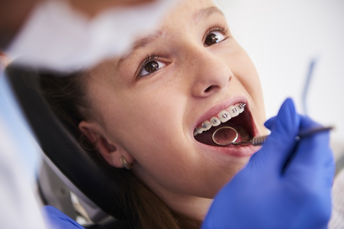 Faculdade de Odontologia precisa de voluntários com aparelho fixo para testar nova pasta de dente