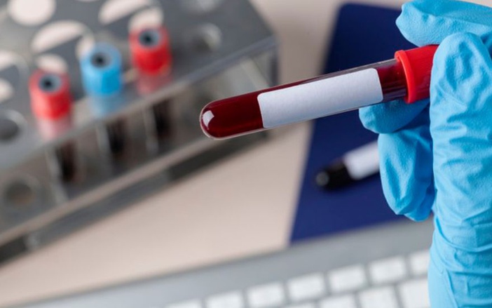 Banco de Sangue de Ribeirão Preto está em estado crítico