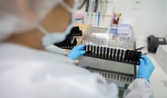 Malária: Anvisa autoriza teste em humanos de vacina 100% brasileira