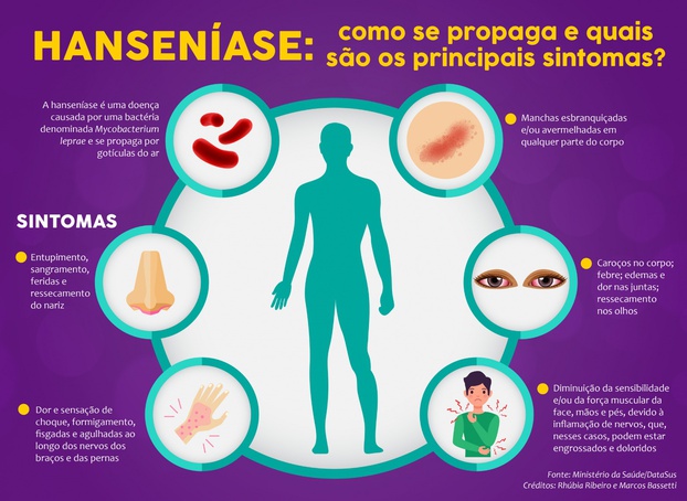 Hanseníase: o que é, causas, sinais e sintomas, tratamento, diagnóstico e  prevenção - Med Mais Vacina