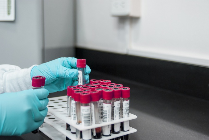 Hemocentro de Ribeirão Preto precisa de doadores de sangue O- e O+