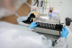 Malária: Anvisa autoriza teste em humanos de vacina 100% brasileira